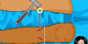 Operate Now: foot surgery
